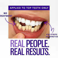 Purple Whitening Strips™